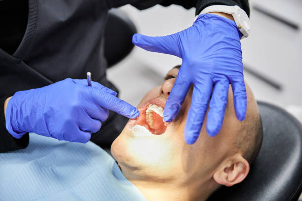 Best Emergency Dentist for Knocked-Out Tooth in Salisbury, MD