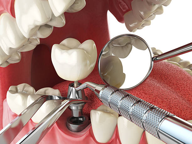 Best Mobile Emergency Dentist in Salisbury, MD